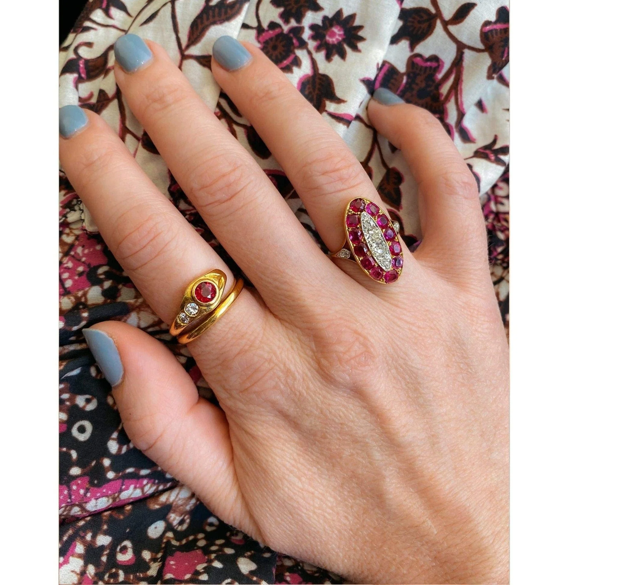 Edwardian Ruby & Diamond Ring - Image 4